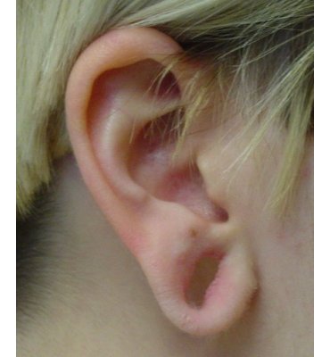 large ear hole before